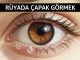 "Rüyada Çapak Görmek"