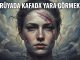 "Rüyada Kafada Yara Görmek"
