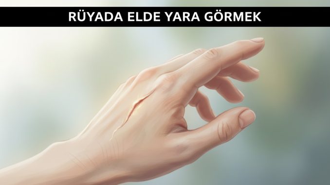 "Rüyada Elde Yara Görmek"