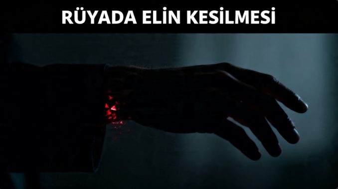 "Rüyada Elin Kesilmesi"