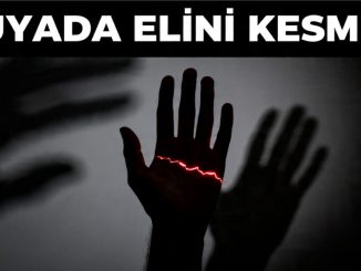 "Rüyada Elini Kesmek"