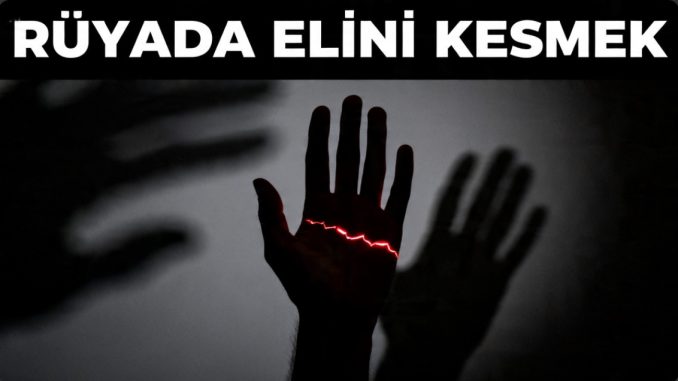"Rüyada Elini Kesmek"