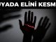 "Rüyada Elini Kesmek"
