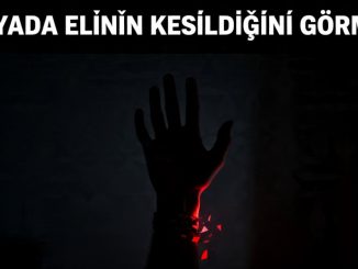 "Rüyada Elinin Kesildiğini Görmek"