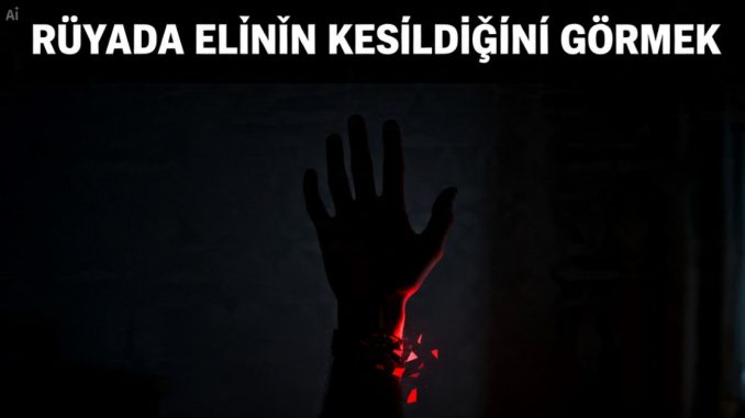 "Rüyada Elinin Kesildiğini Görmek"