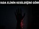 "Rüyada Elinin Kesildiğini Görmek"