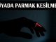 "Rüyada Parmak Kesilmesi"